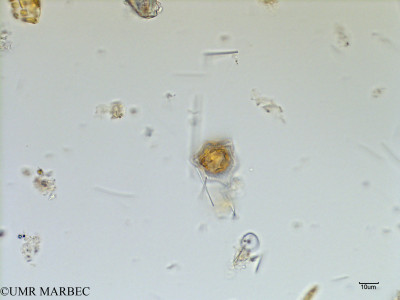 phyto/Scattered_Islands/mayotte_lagoon/SIREME May 2016/Triceratium dubium (MAY7_triceratium cf sp6 a verifier-2).tif(copy)_thumb.jpg